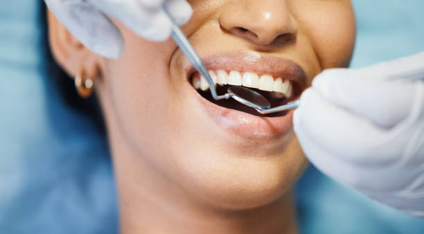 Best Pediatric Emergency Dentist in Arial, SC