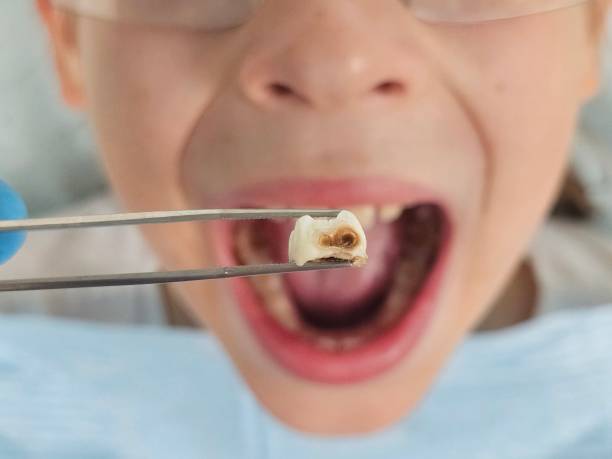 Best Broken or Cracked Tooth Emergency Dentist in Arial, SC